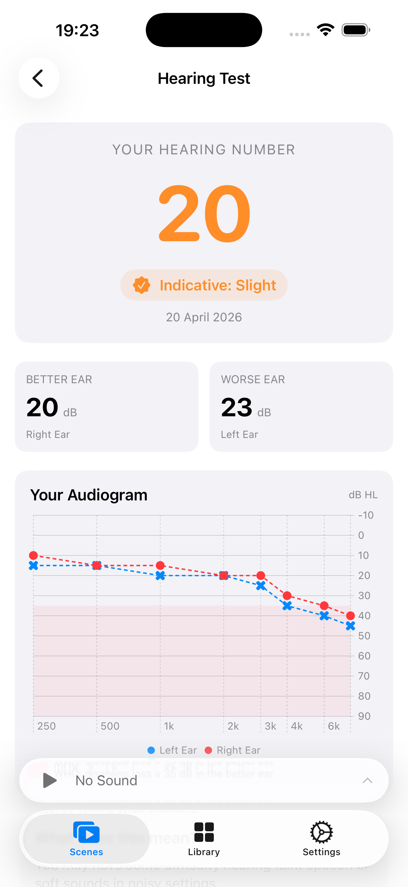 Tinni App Pure-Tone Audiometry Hearing Test Results showing Audiogram and Hearing Number